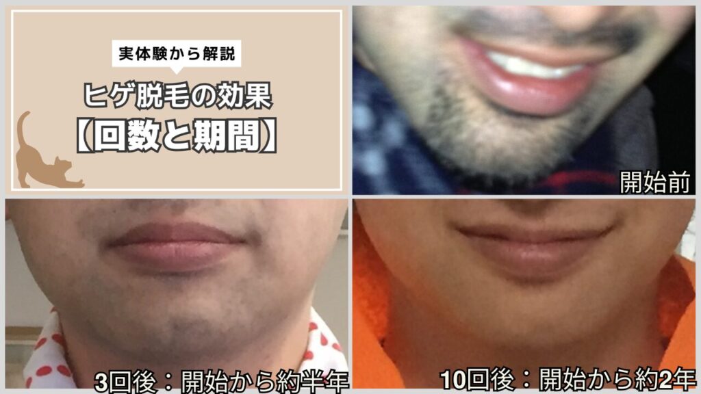 ヒゲ脱毛 回数と期間