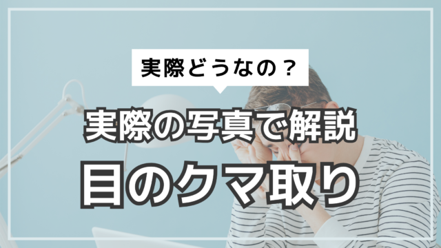 アイキャッチ　目のクマ取り　写真でレビュー