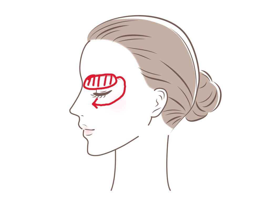 目のクマ　施術内容