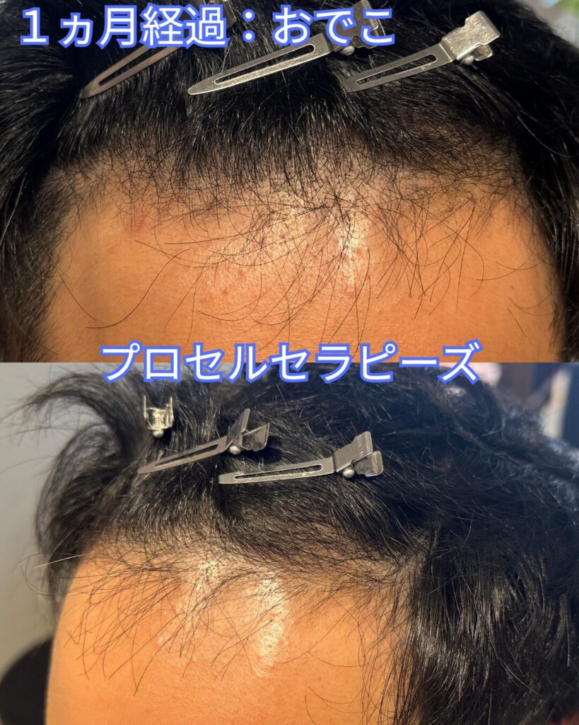 プロセル　1ヵ月経