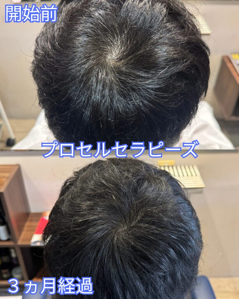 プロセル　経過写真