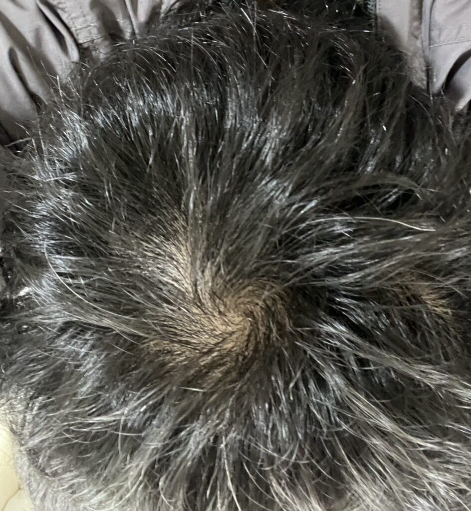 プロセル　2週間経過