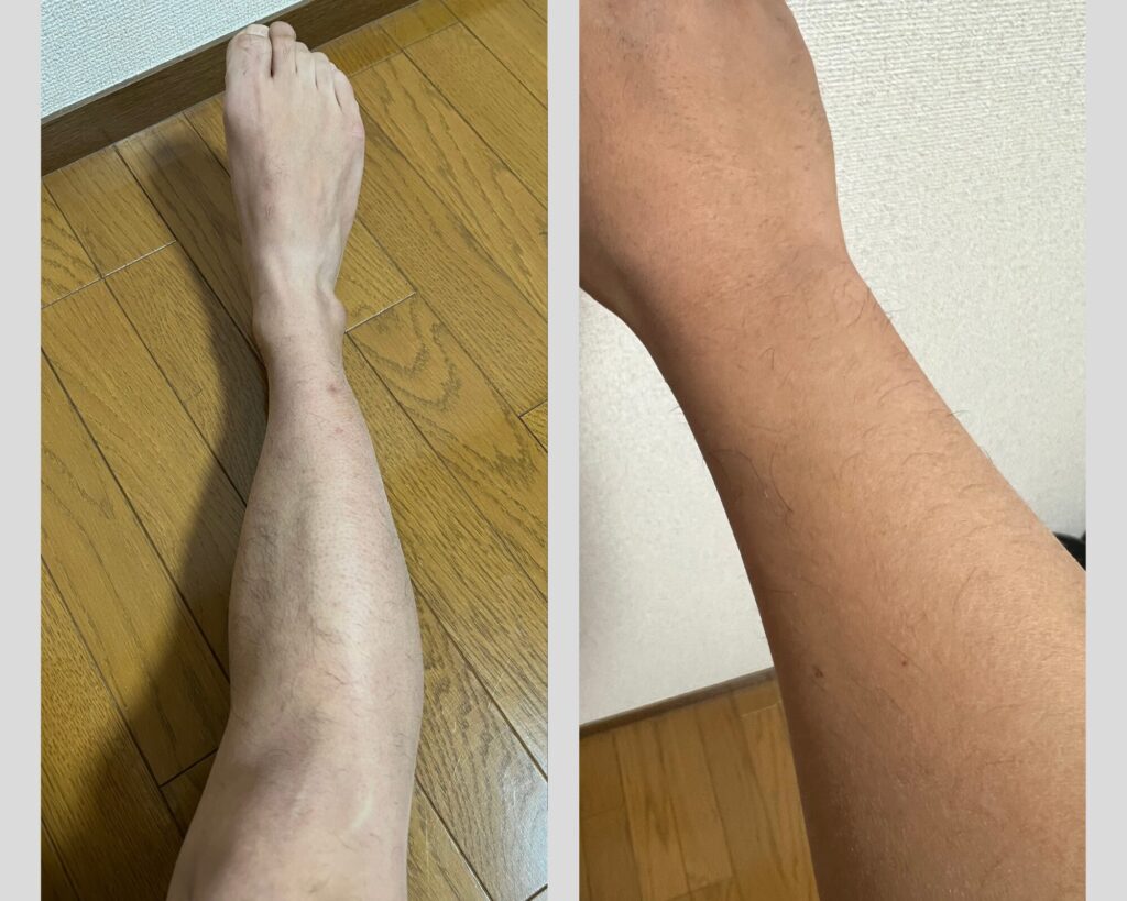 すね毛　腕毛