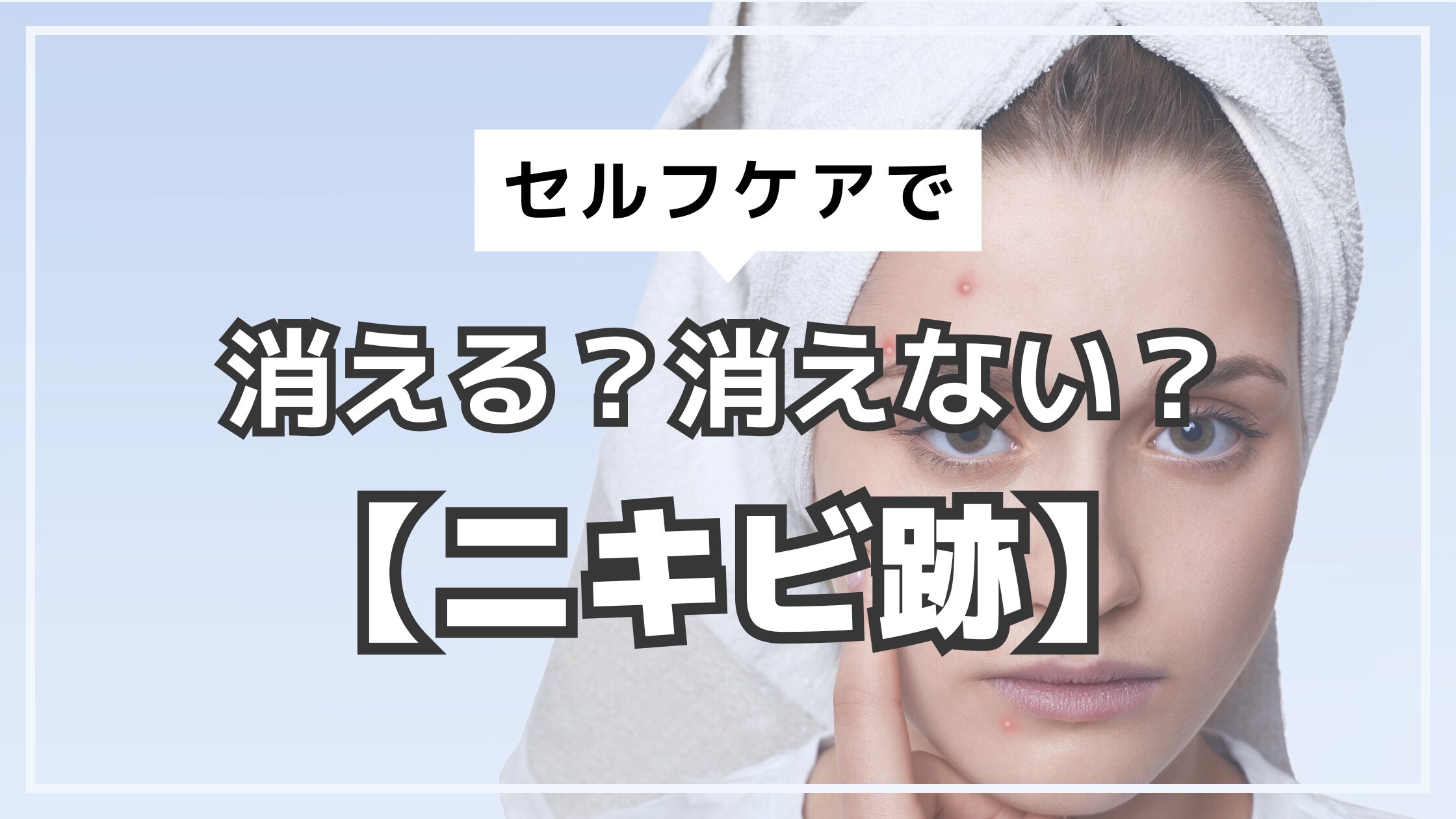 アイキャッチ　ニキビ跡