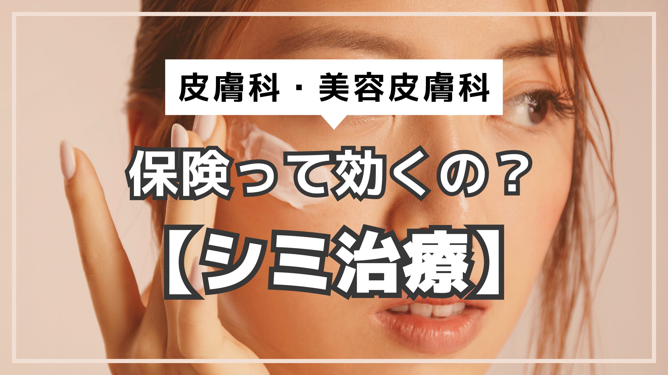 アイキャッチ　シミ　保険効くの